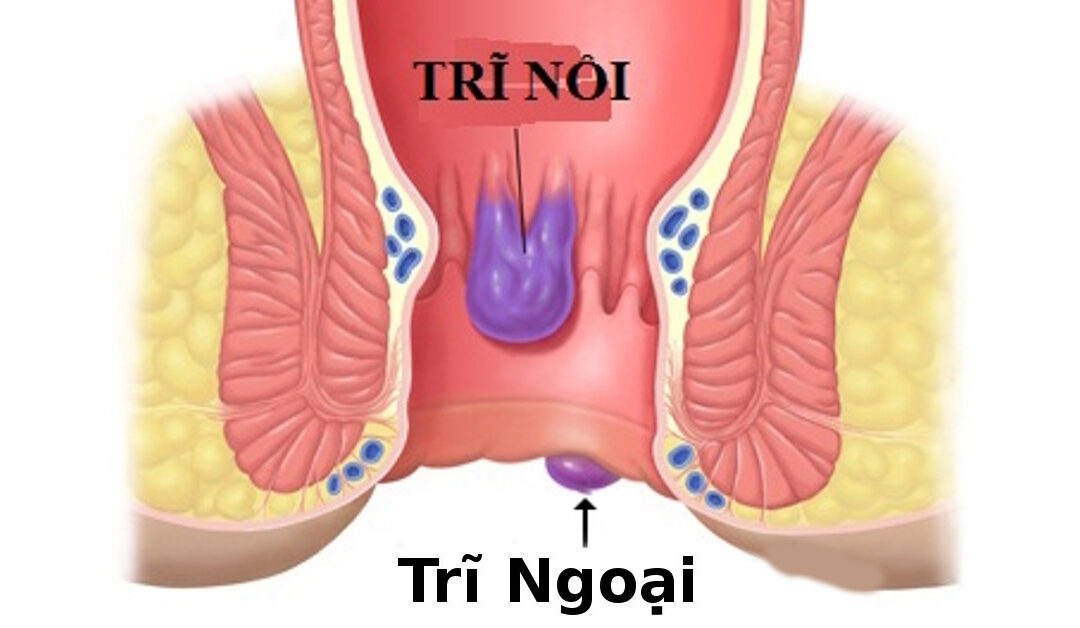 Đau Vùng Tầng Sinh Môn Nam Giới: Dấu Hiệu, Phương Pháp & Địa Chỉ Uy Tín Tại Tuyên Quang