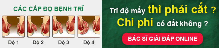 Ảnh mô tả các cấp độ của bệnh trĩ