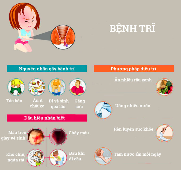 Sơ đồ hệ tiêu hóa và vị trí trĩ nội, trĩ ngoại khi ngồi vệ sinh.